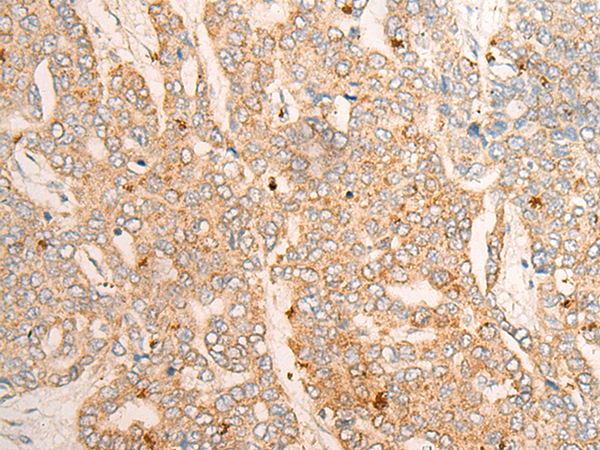 TMEM67 Antibody