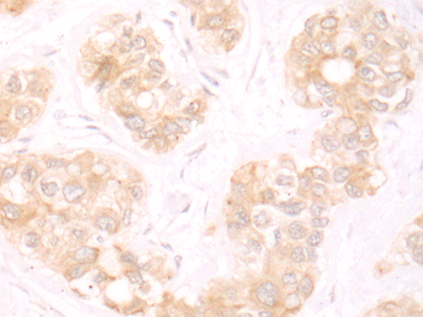 TRMT1 Antibody