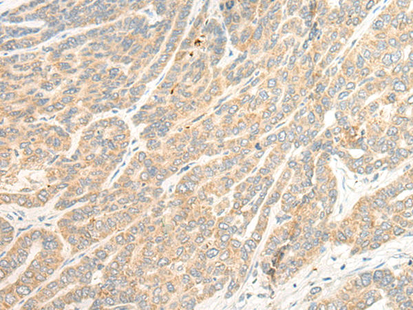 TTC4 Antibody