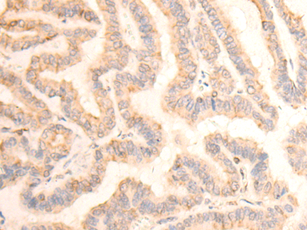 TUBA1B Antibody