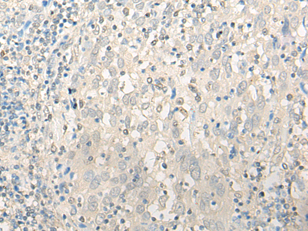 UBXN1 Antibody
