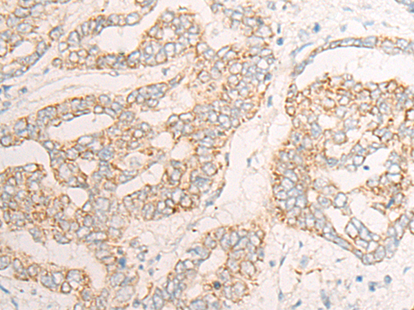 UQCR10 Antibody
