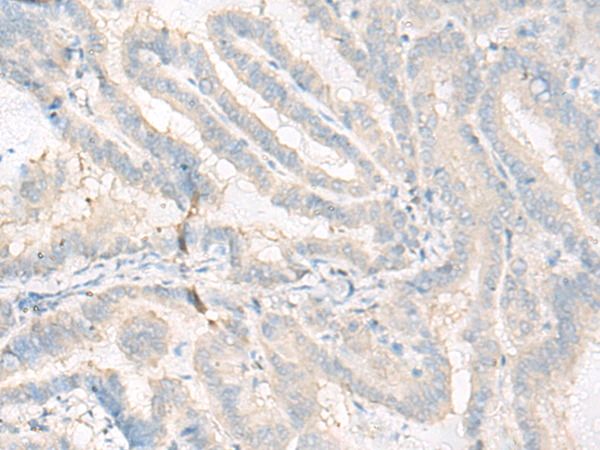 WDR1 Antibody