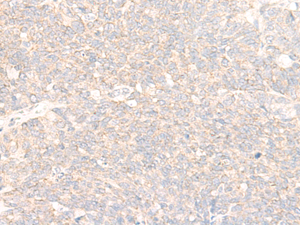 XPNPEP3 Antibody