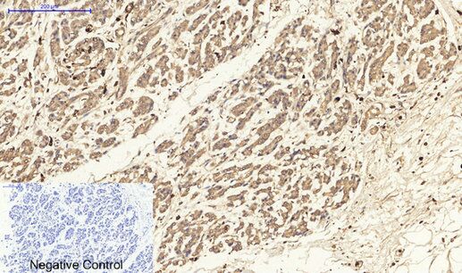 PKC Polyclonal Antibody