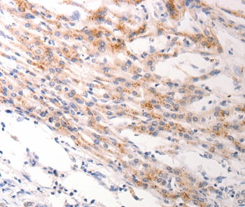 KRT6A/KRT6B/KRT6C Antibody