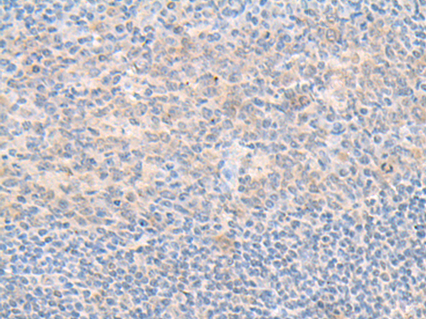 SMS Antibody