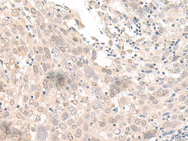OLA1 Antibody