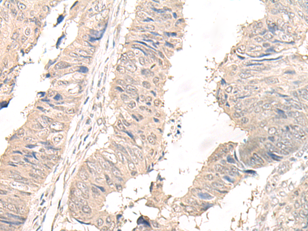 OLA1 Antibody