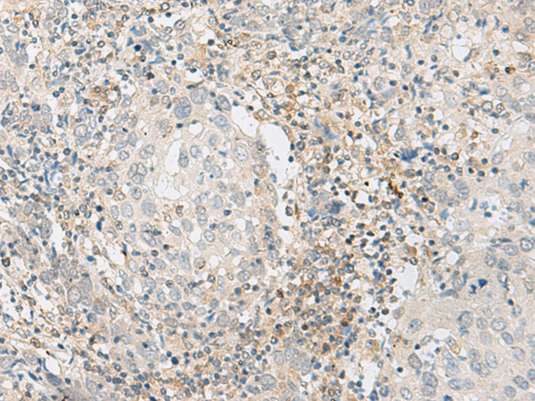 ZBTB8A Antibody