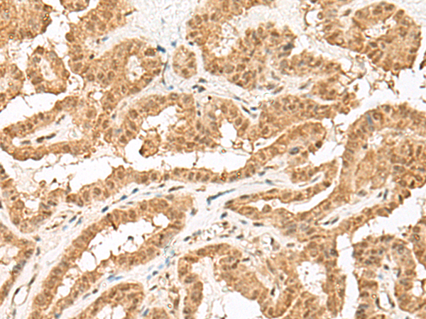 ZBTB8A Antibody