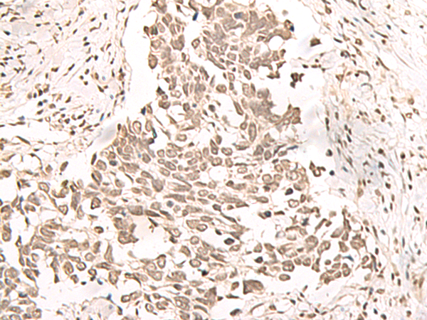 RRP1 Antibody
