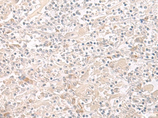 THADA Antibody