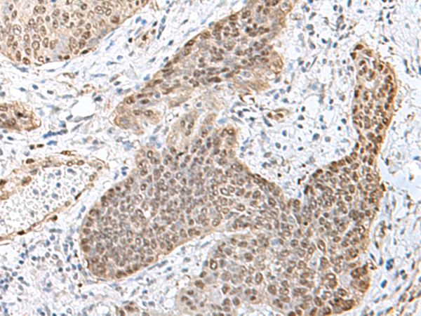 TCF25 Antibody