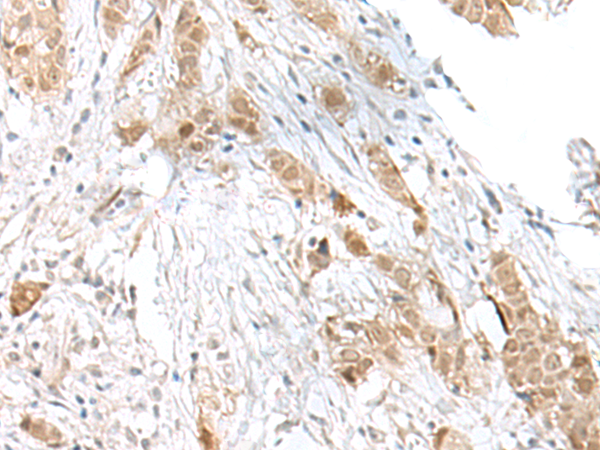 TCF25 Antibody