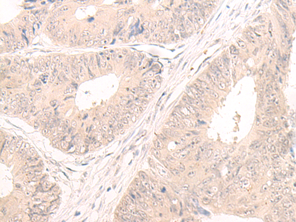 LCMT2 Antibody