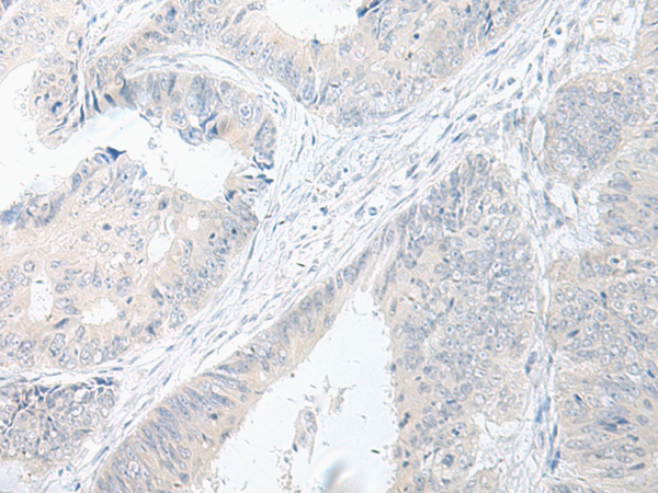 GPRASP2 Antibody