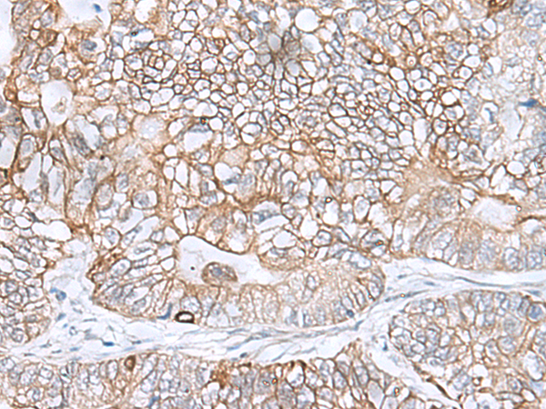 C9orf116 Antibody