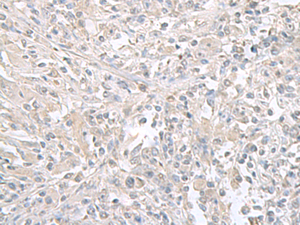 FXYD6 Antibody