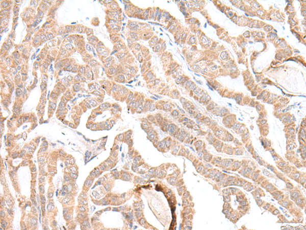 PLGLB2 Antibody