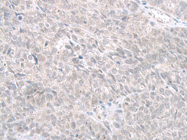 STAU2 Antibody