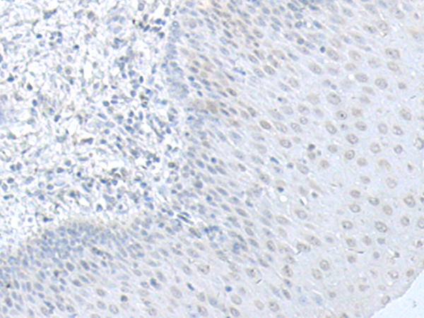 C8orf4 Antibody