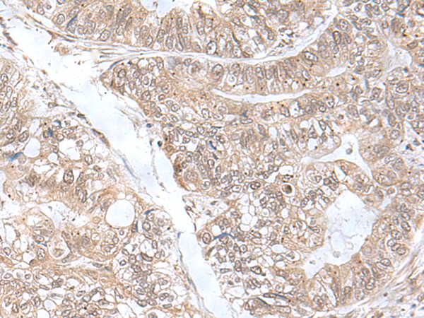 SNRNP25 Antibody