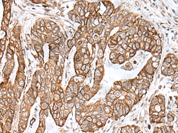 RNF111 Antibody