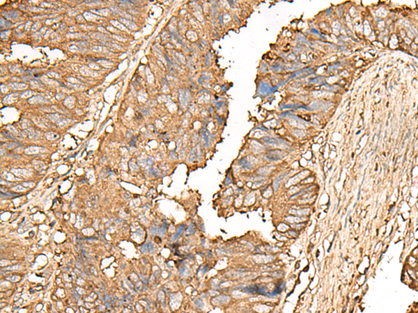 UBE2A Antibody