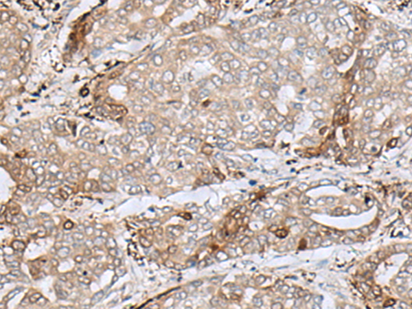 MRM1 Antibody