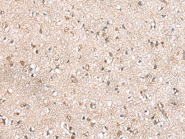 RPL23A Antibody