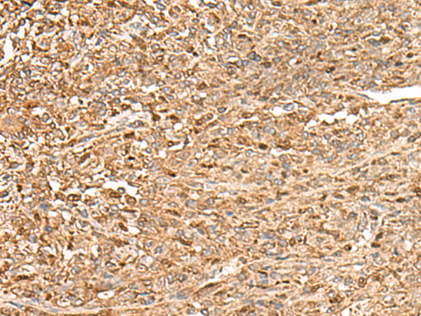 ZC3H7A Antibody