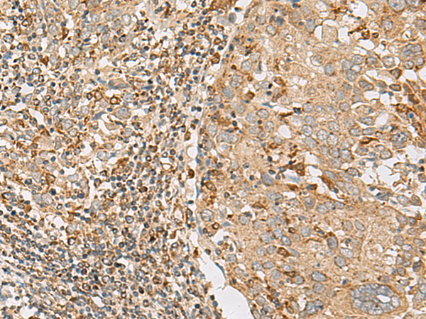 ZC3H7A Antibody
