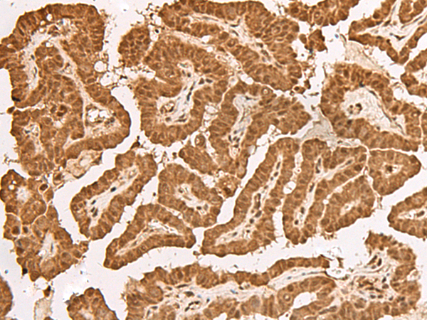 TIPRL Antibody