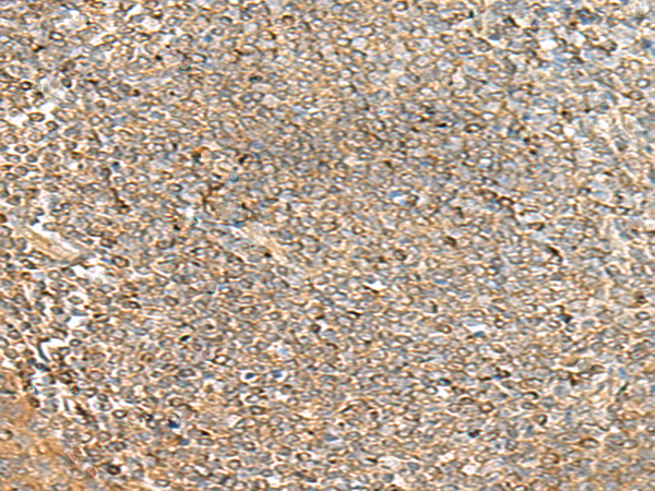 PCTP Antibody