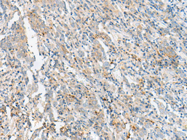 CTRB1 Antibody