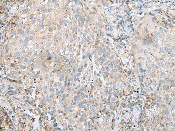 SEPT1 Antibody