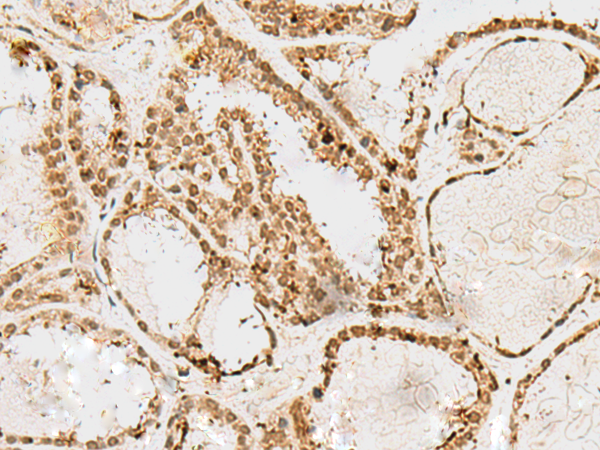 SNAPC1 Antibody