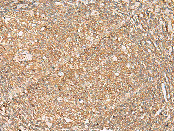 FNTB Antibody