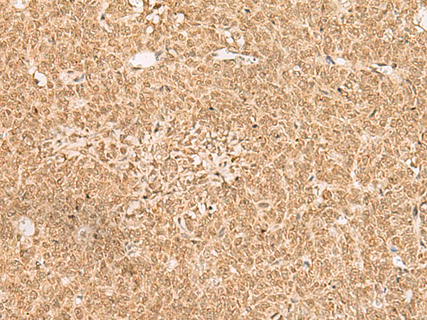 EXD2 Antibody