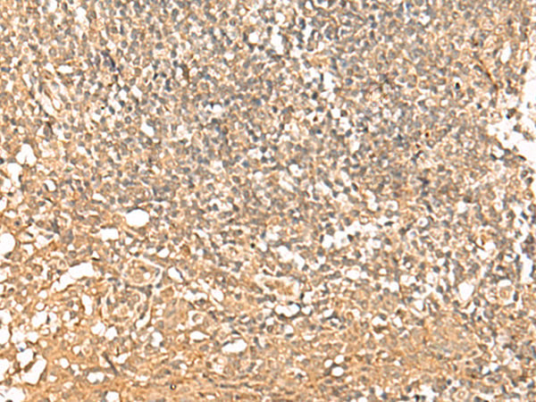 PWP1 Antibody
