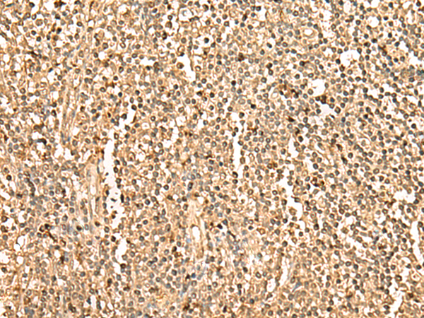 PPM1G Antibody