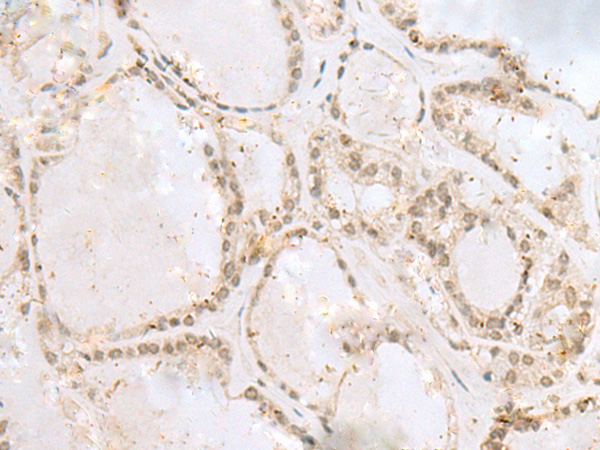 RABGGTA Antibody