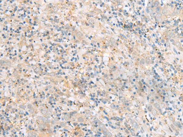 RABGGTA Antibody