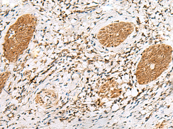 NUP58 Antibody