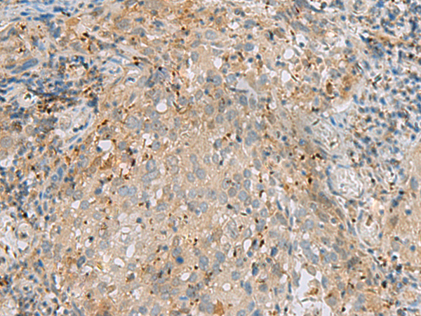 ECD Antibody