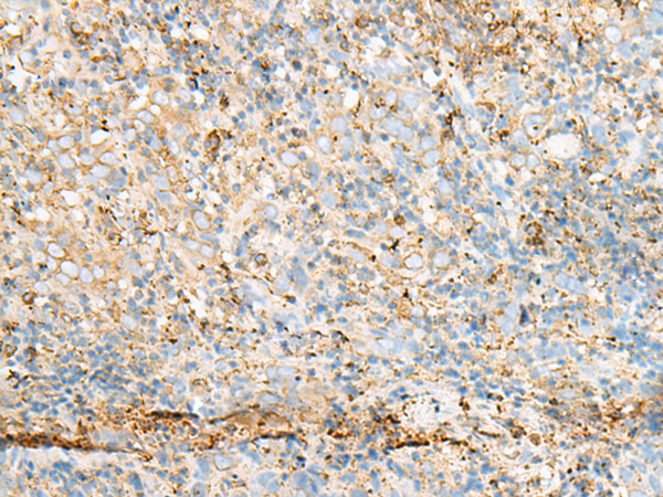 PDIA4 Antibody