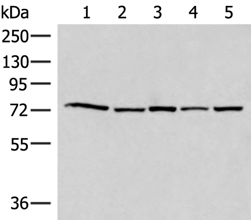 ATMIN Antibody