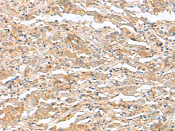 TTC12 Antibody
