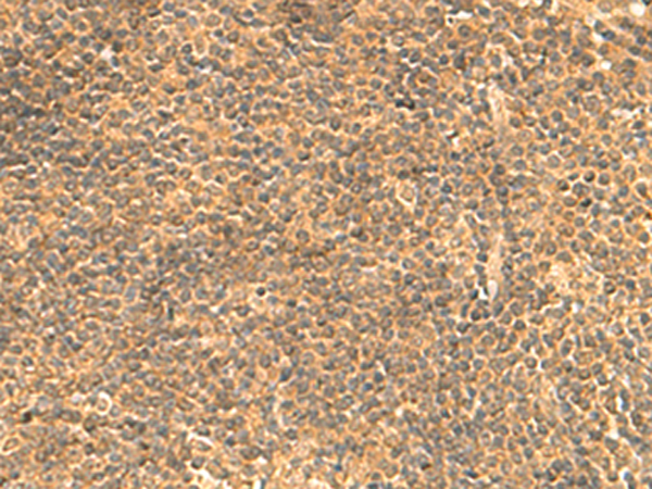 FAM186B Antibody